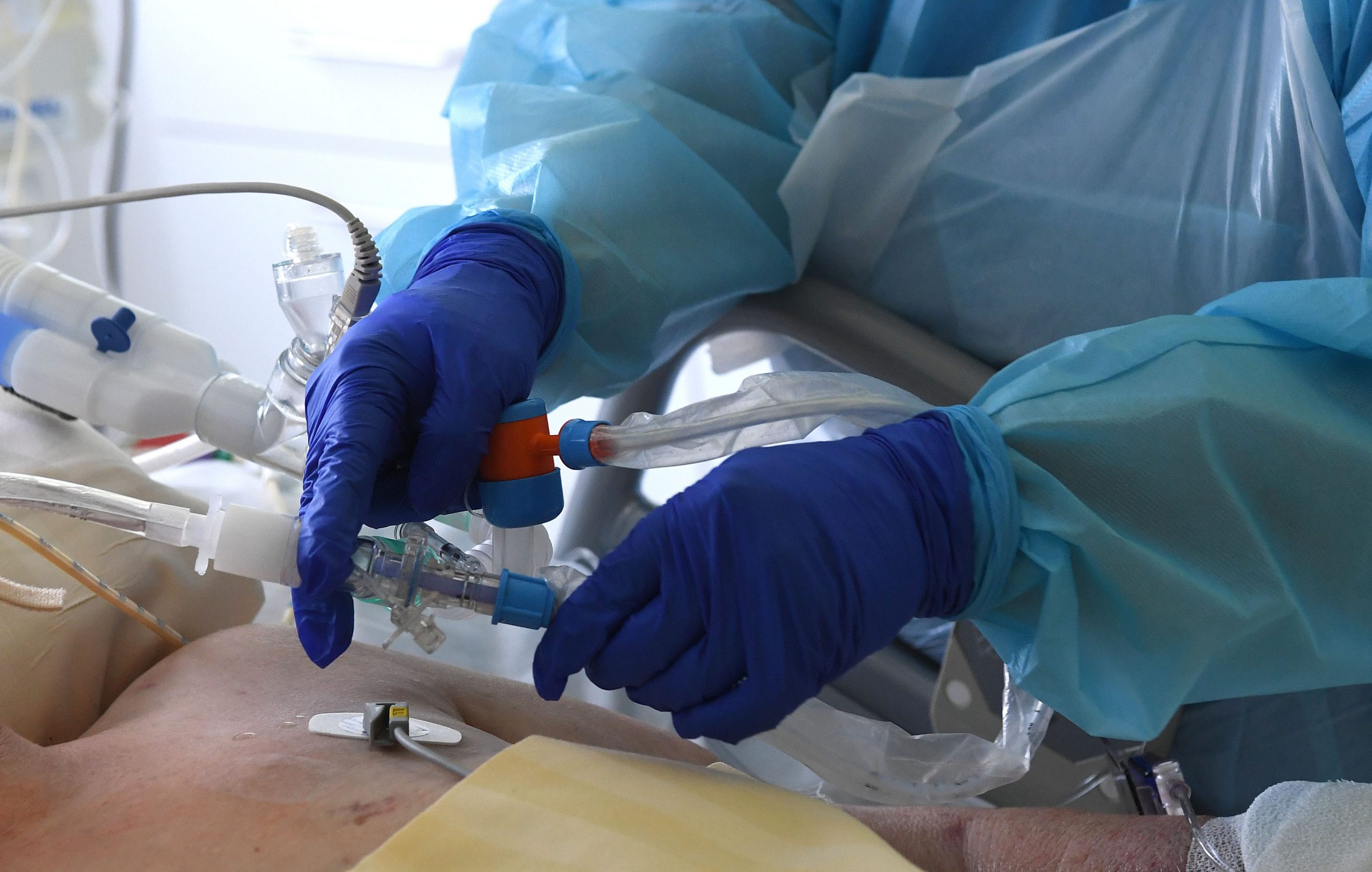 Image accompanying Corona-Geimpfte, die wegen eines schweren Verlaufs auf der Intensivstation sind, werden im Krankenhaus Bludenz auf ungeimpft „umgestellt”, da sie trotz Impfung